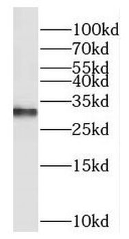 EXOSC3 Antibody