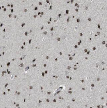 EXOSC4 Antibody