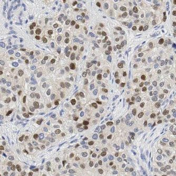 EXOSC5 Antibody