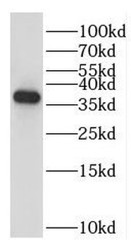 EXOSC7 Antibody