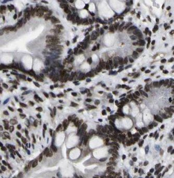 EXOSC7 Antibody