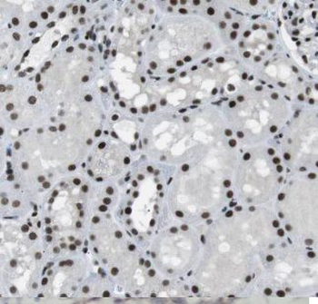 EYA1 Antibody