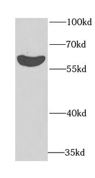 EYA3 Rabbit Polyclonal Antibody