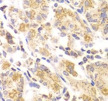 EYA3 Rabbit Polyclonal Antibody