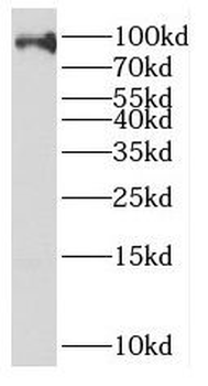 EZH1 Rabbit Polyclonal Antibody