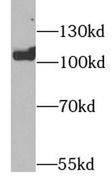 EZH2 Antibody