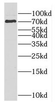 F2 Rabbit Polyclonal Antibody