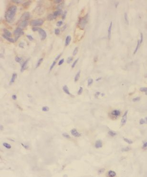 FA2H Antibody