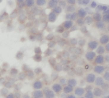 FAAH Antibody