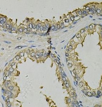 FABP1 Antibody