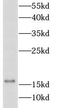 FABP2 Rabbit Polyclonal Antibody