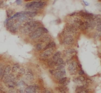 FABP2 Rabbit Polyclonal Antibody