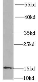 FABP4 Antibody