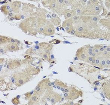 FABP5 Antibody