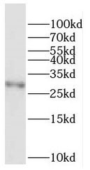F12 Antibody