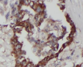 FADD Rabbit Polyclonal Antibody