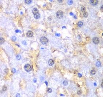 FAH Antibody