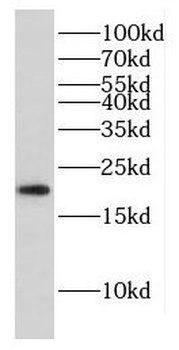 FAIM Antibody