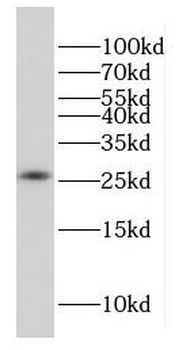 RFLNA Antibody