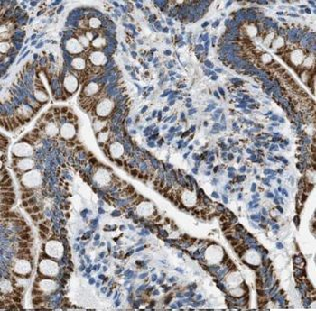 FAM111B Antibody
