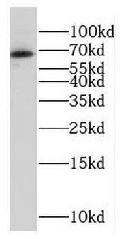 DENND6B Antibody