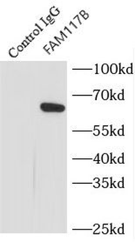 FAM117B Rabbit Polyclonal Antibody