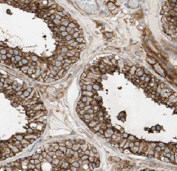 FAM133A Rabbit Polyclonal Antibody