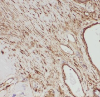 EMC9 Antibody