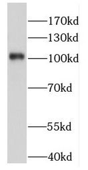 FHIP2A Antibody