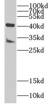 FAM185A Antibody
