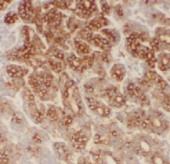 FAM185A Antibody