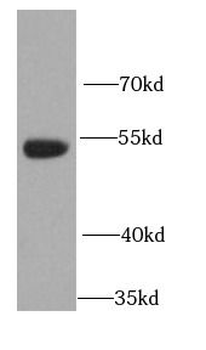 FAM20A Rabbit Polyclonal Antibody
