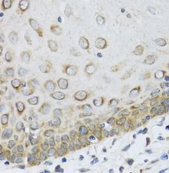 FAM20A Rabbit Polyclonal Antibody