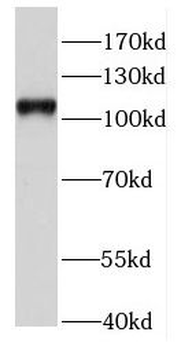HAUS6 Antibody