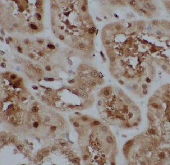 CYRIB Antibody