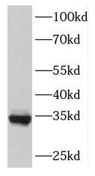 GARIN5B Rabbit Polyclonal Antibody