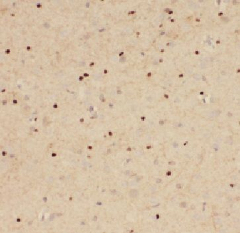 GARIN5B Rabbit Polyclonal Antibody