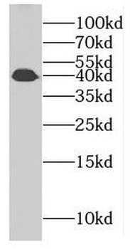 GARIN1A Antibody