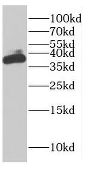 FAM76A Antibody