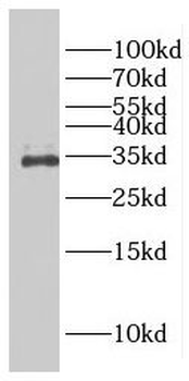 FAM78A Antibody
