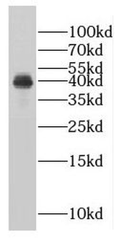 LRATD2 Antibody