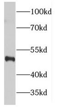 FANCC Antibody
