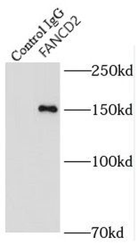 FANCD2 Antibody