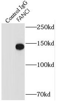 FANCI Antibody