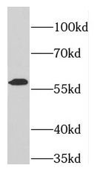 FARSA Antibody