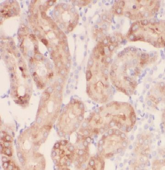 FARSA Antibody