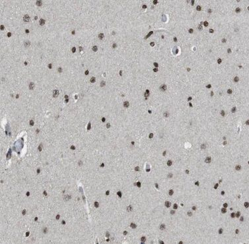 FARSB Antibody