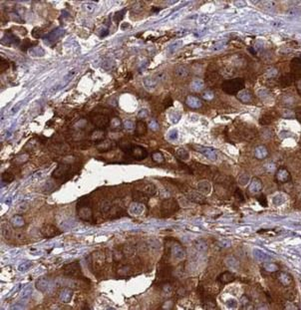 FAS Antibody