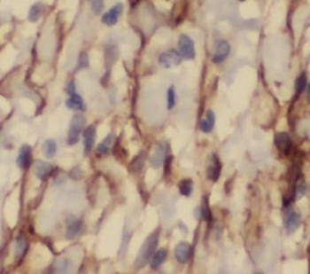 FAS Antibody