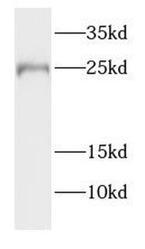 FATE1 Rabbit Polyclonal Antibody